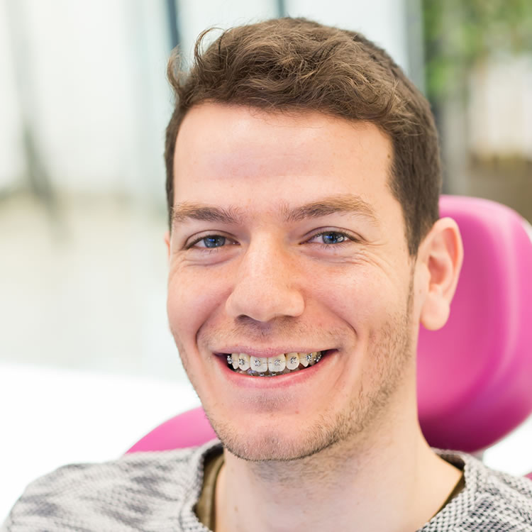 Diş Teli Tedavisine Ne Zaman Başlanmalı? - Dentvizyon