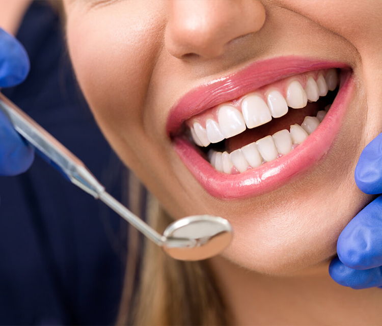Bonding Nedir? Nasıl Yapılır?